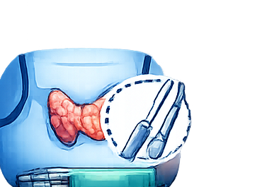 Thyroid Surgery